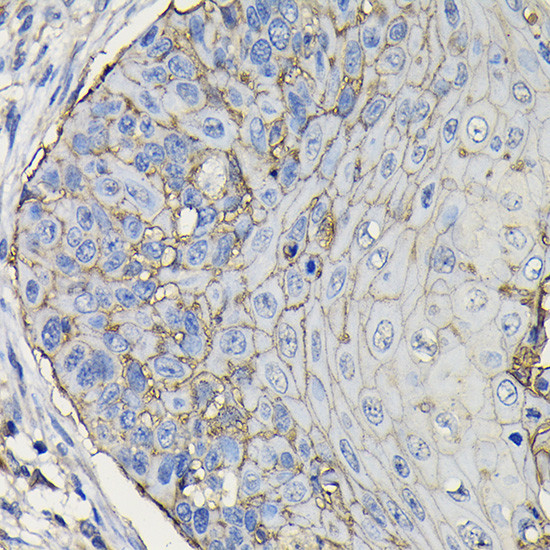 TROP2 Antibody in Immunohistochemistry (Paraffin) (IHC (P))