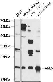 ARL6 Antibody in Western Blot (WB)