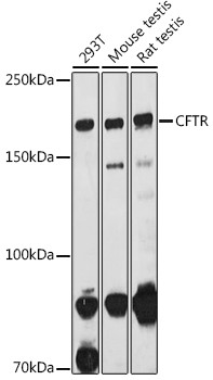 CFTR Antibody in Western Blot (WB)