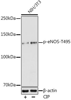 Phospho-eNOS (Thr495) Antibody in Western Blot (WB)