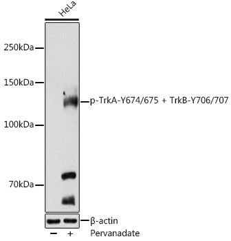 Phospho-TrkA/TrkB (Tyr674, Tyr675, Tyr706, Tyr707) Antibody in Western Blot (WB)