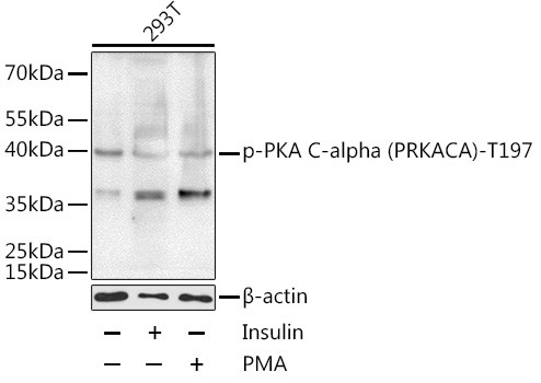 Phospho-PKA alpha (Thr197) Antibody in Western Blot (WB)