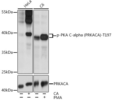 Phospho-PKA alpha (Thr197) Antibody in Western Blot (WB)