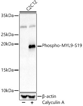 Phospho-MYL9 (Ser19) Antibody in Western Blot (WB)