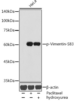 Phospho-Vimentin (Ser83) Antibody in Western Blot (WB)