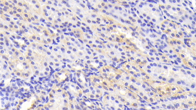 Tankyrase 2 Antibody in Immunohistochemistry (Paraffin) (IHC (P))