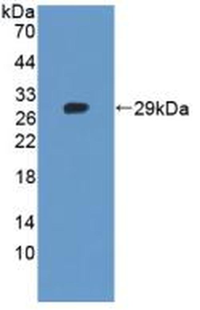 Tankyrase 2 Antibody in Western Blot (WB)