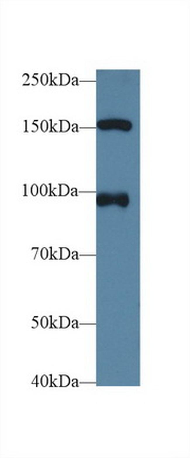 NUP98 Antibody in Western Blot (WB)