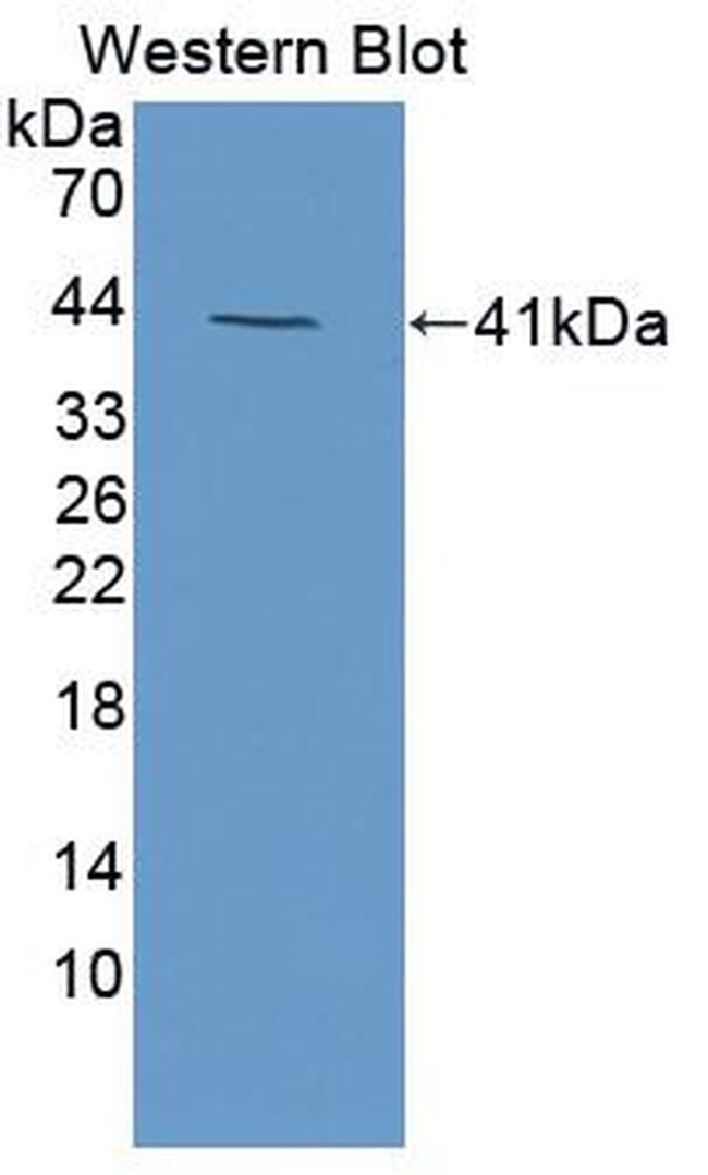 NMB Antibody in Western Blot (WB)