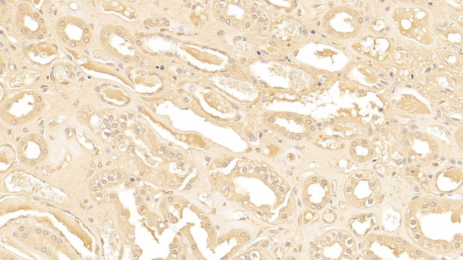 SERPINA3 Antibody in Immunohistochemistry (Paraffin) (IHC (P))