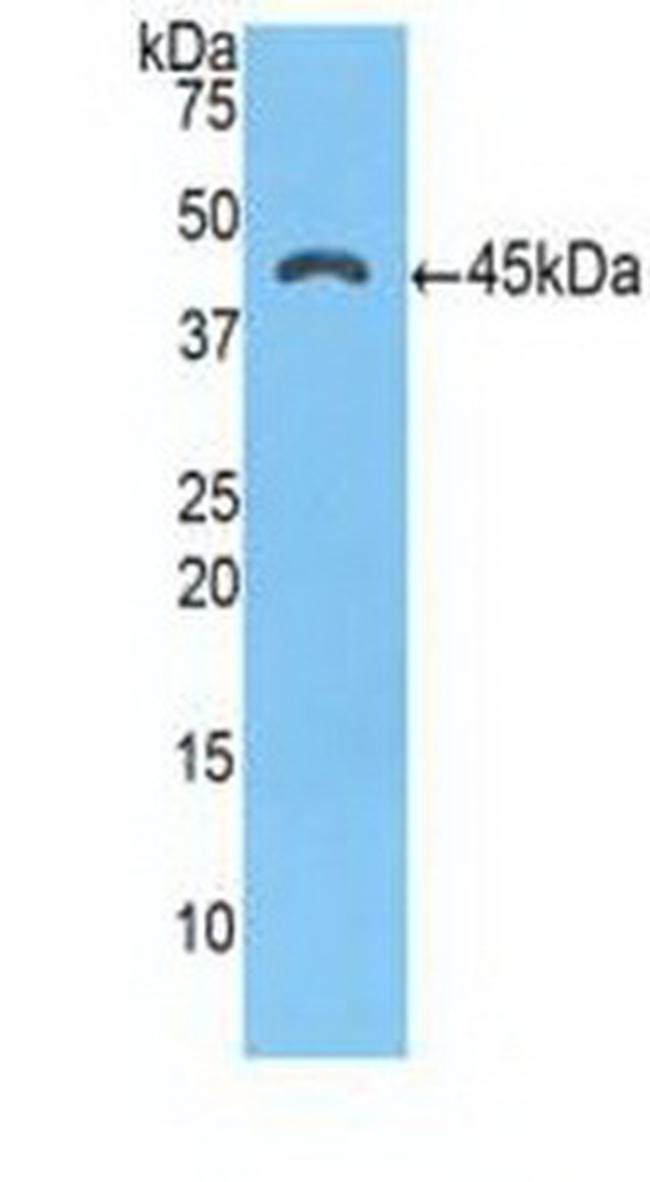 SERPINA3 Antibody in Western Blot (WB)