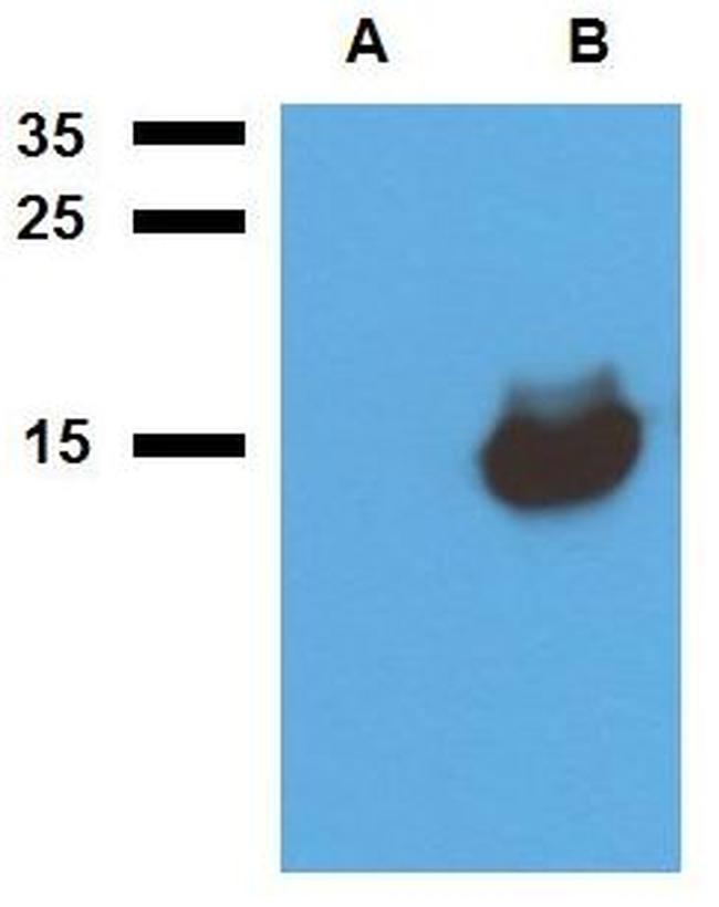 Mycobacterium tuberculosis Acr1 Antibody in Western Blot (WB)