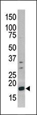 Phospho-Histone H3 (Ser10) Antibody in Western Blot (WB)