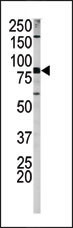 Phospho-Amyloid Precursor Protein (Ser730) Antibody in Western Blot (WB)