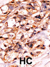 Phospho-BAD (Ser118) Antibody in Immunohistochemistry (Paraffin) (IHC (P))