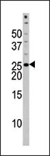 Phospho-BAD (Ser118) Antibody in Western Blot (WB)