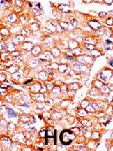 Phospho-BID (Ser65) Antibody in Immunohistochemistry (Paraffin) (IHC (P))