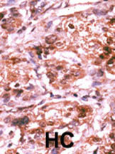 Phospho-Cdc25A (Ser293) Antibody in Immunohistochemistry (Paraffin) (IHC (P))