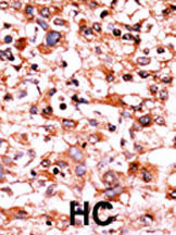 Phospho-CDK1 (Ser39) Antibody in Immunohistochemistry (Paraffin) (IHC (P))