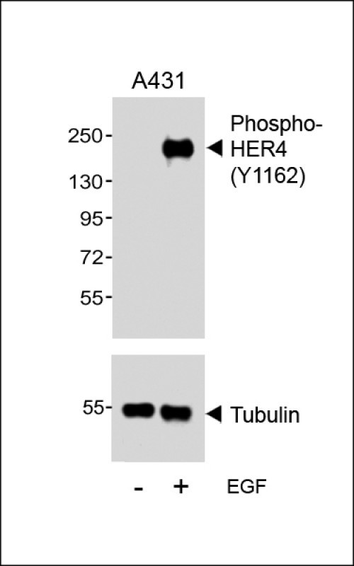 Phospho-ErbB4 (Tyr1162) Antibody in Western Blot (WB)