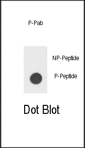 Phospho-CSF2RB (Tyr766) Antibody in Dot Blot (DB)