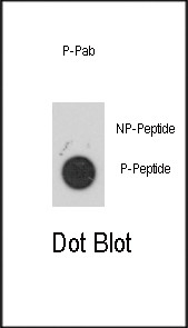 Phospho-MAPKAPK2 (Ser272) Antibody in Dot Blot (DB)
