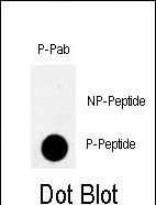 Phospho-PKMYT1 (Thr495) Antibody in Dot Blot (DB)