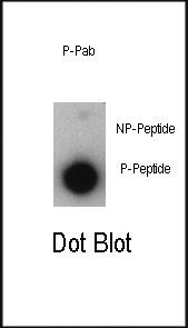 Phospho-p21 (Thr57) Antibody in Dot Blot (DB)