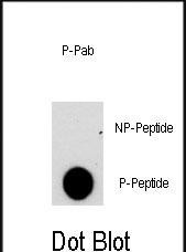 Phospho-NFATC2 (Ser330) Antibody in Dot Blot (DB)