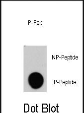 Phospho-c-Raf (Tyr340) Antibody in Dot Blot (DB)