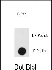 Phospho-DNA-PK (Thr2609) Antibody in Dot Blot (DB)