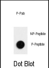 Phospho-LC3B (Thr12) Antibody in Dot Blot (DB)