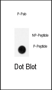 Phospho-GIT1 (Tyr554) Antibody in Dot Blot (DB)