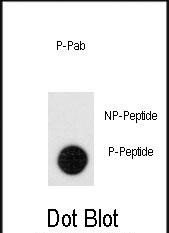 Phospho-LEO1 (Ser551) Antibody in Dot Blot (DB)