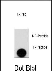Phospho-LEO1 (Ser10) Antibody in Dot Blot (DB)