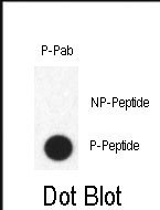 Phospho-FABP4 (Tyr20) Antibody in Dot Blot (DB)