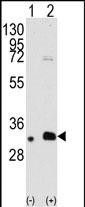 MAGEB2 Antibody in Western Blot (WB)