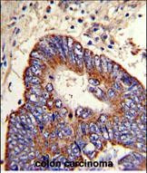 MMP15 Antibody in Immunohistochemistry (Paraffin) (IHC (P))