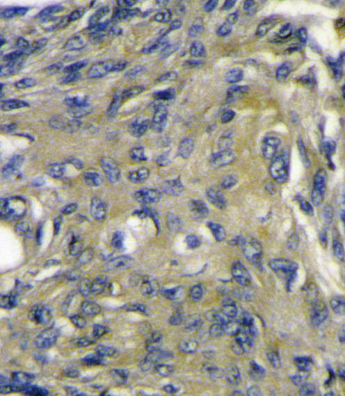 VEGFD Antibody in Immunohistochemistry (Paraffin) (IHC (P))