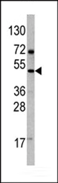 VEGFD Antibody in Western Blot (WB)