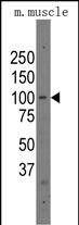 PARP12 Antibody in Western Blot (WB)