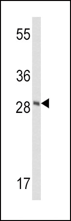 FXN Antibody in Western Blot (WB)