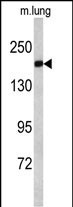 Alsin Antibody in Western Blot (WB)