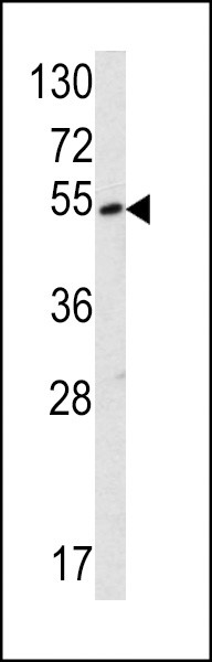 SUV420H2 Antibody in Western Blot (WB)