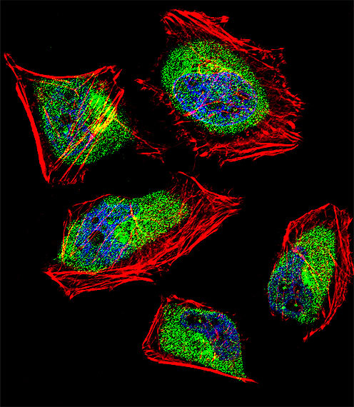 CNOT8 Antibody in Immunocytochemistry (ICC/IF)