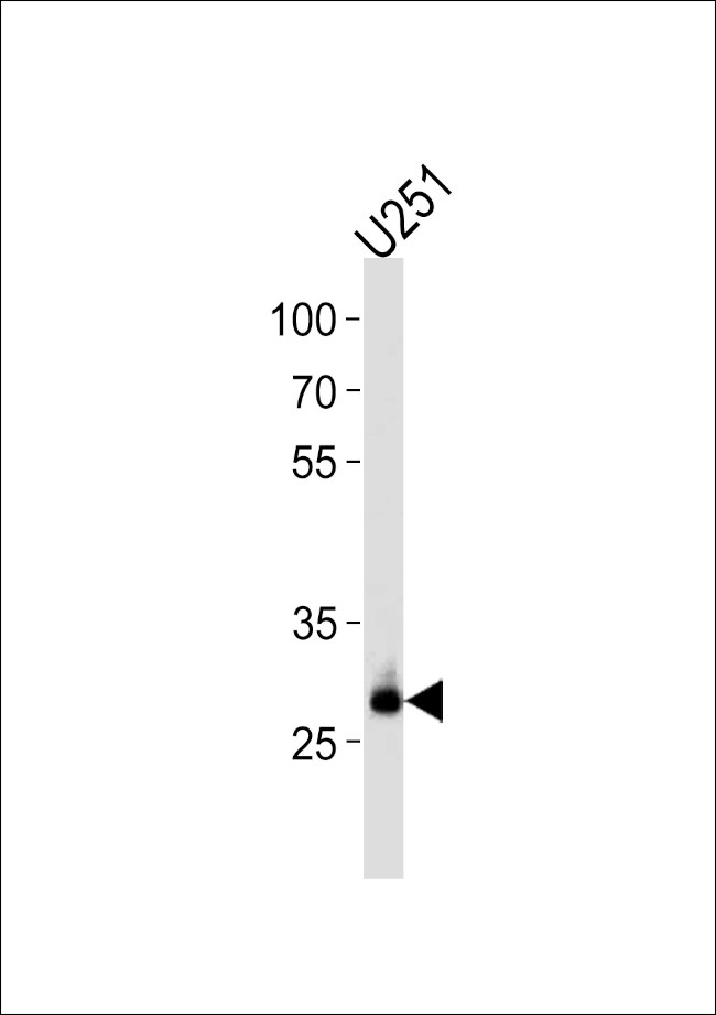 CNOT8 Antibody in Western Blot (WB)