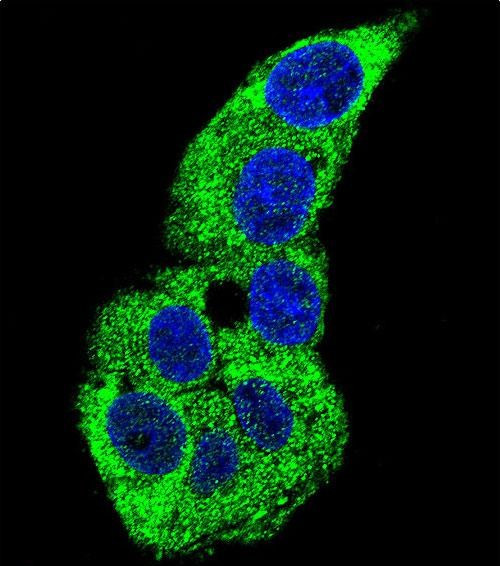 gamma Actin Antibody in Immunocytochemistry (ICC/IF)