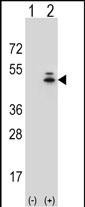 gamma Actin Antibody in Western Blot (WB)