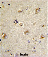 CDCA3 Antibody in Immunohistochemistry (Paraffin) (IHC (P))