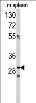 CDCA3 Antibody in Western Blot (WB)